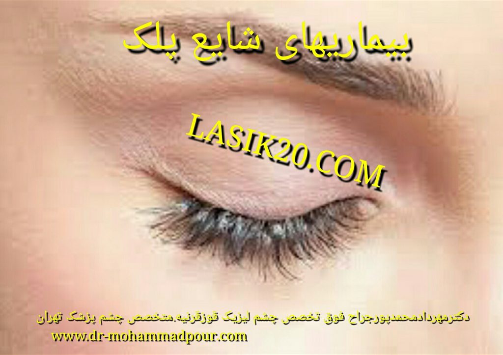 بیماریهای شایع پلک