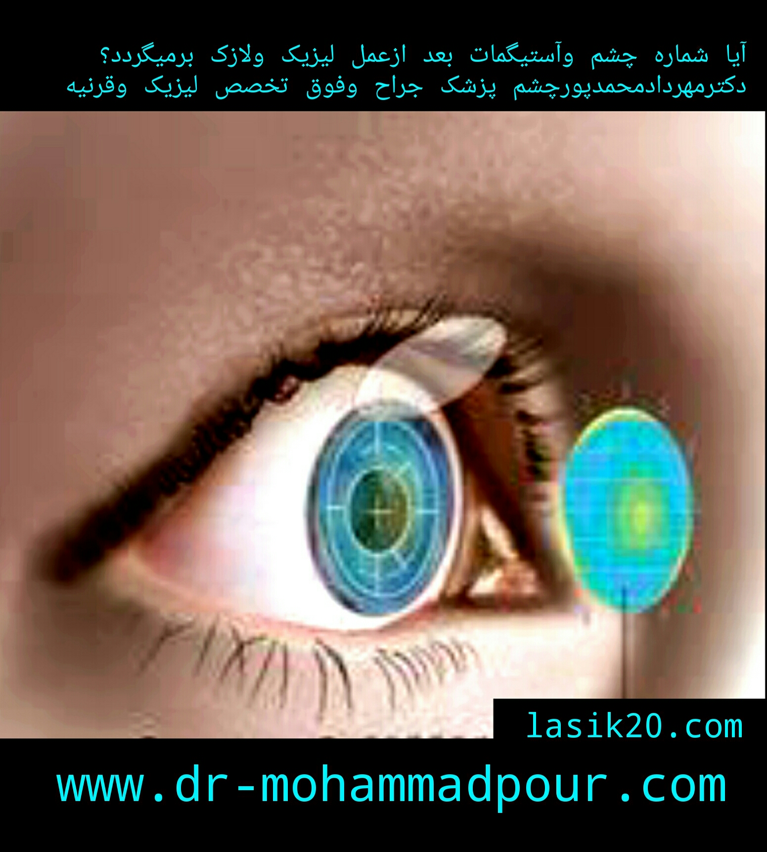 آیا شماره چشم وآستیگمات بعد از عمل لیزیک ولازک برمیگردد