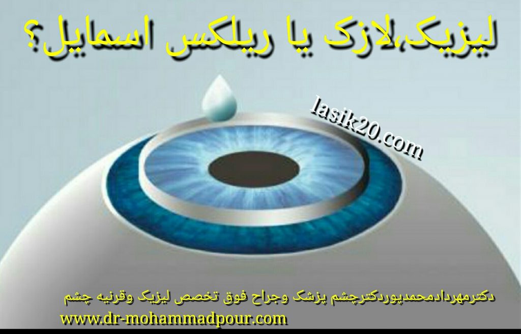 من خشکی چشم دارم کدام عمل برایم مناسب تر است؟