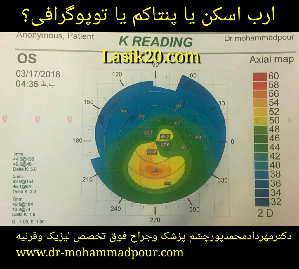 توپوگرافی یا ارب اسکن یا پنتاکم