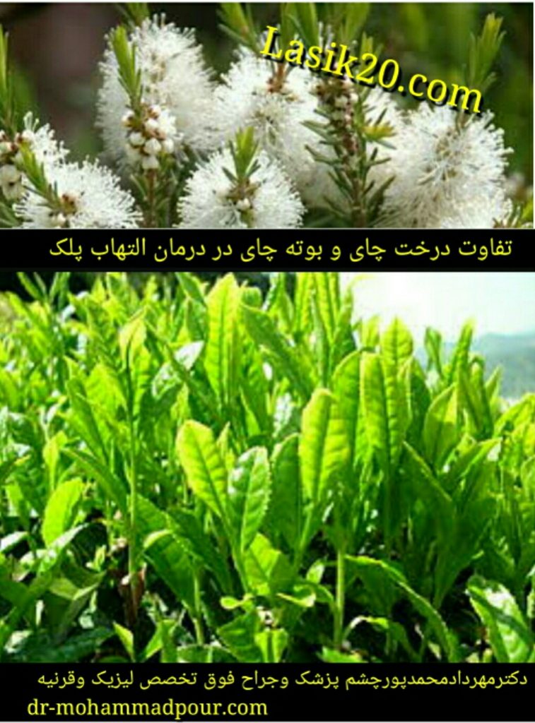 تفاوت بین درخت چایTea Tree Oil و بوته چای در درمان التهاب لبه پلک