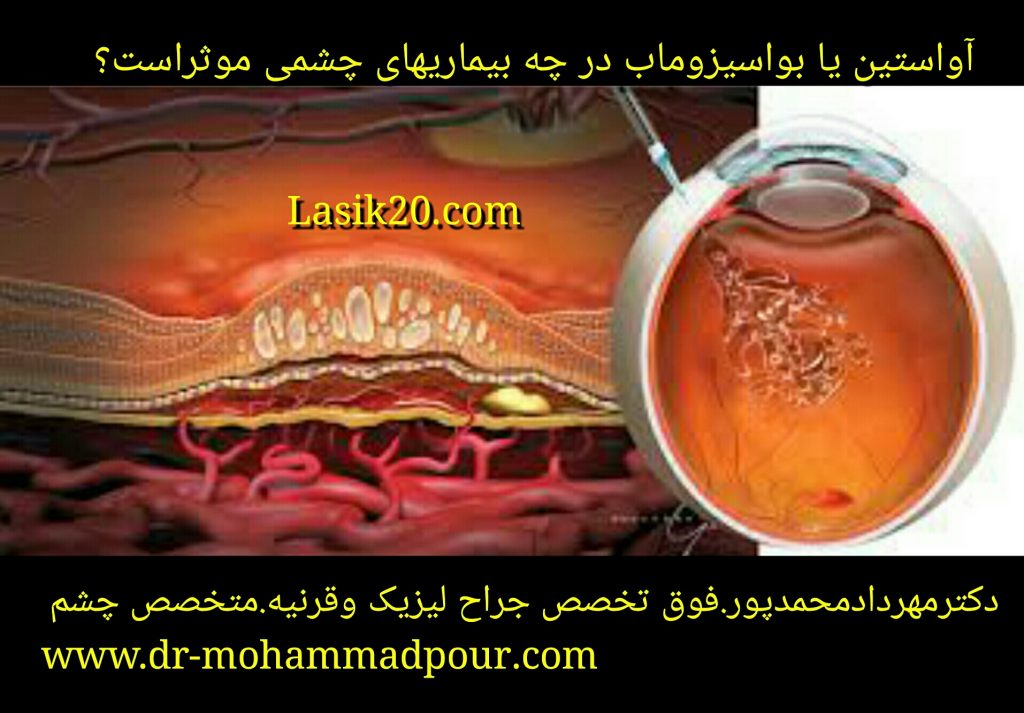 آواستین در چه بیماریهای چشمی موثراست؟