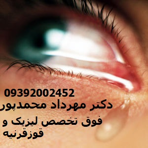آلرژی چشم چیست؟