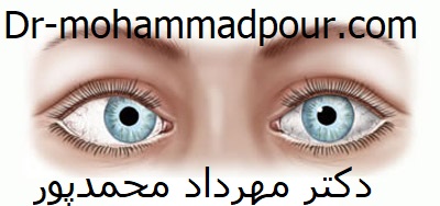 انواع انحرافات چشم